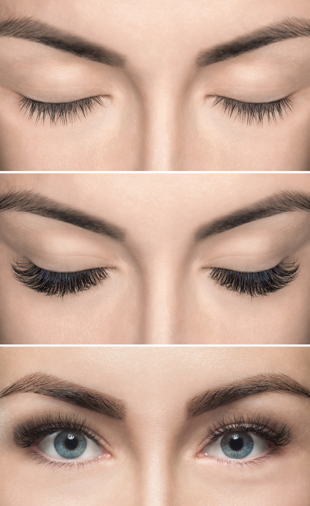 Eyelash removal procedure before and after close up.